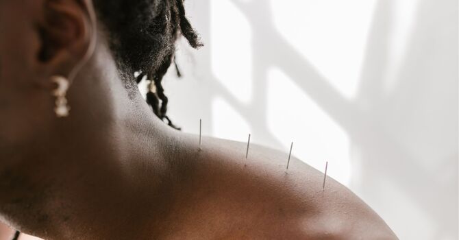 Cupping